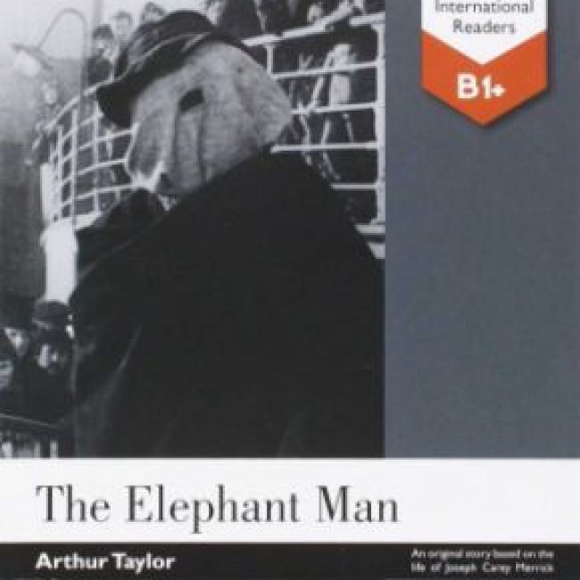The Elephant Man, Tim Vicary, Burlington